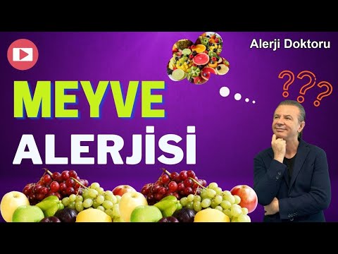 Video: Oral Alerji Sendromunu Teşhis Etmenin 3 Yolu