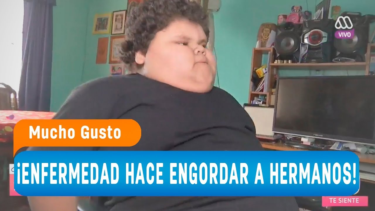 ¡Extraña enfermedad hace engordar a hermanos! - Mucho gusto 2018