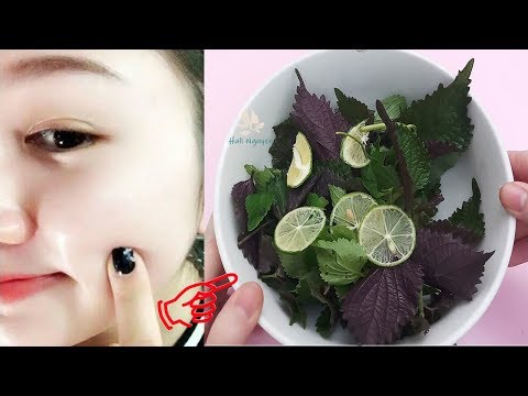 Video Xông hơi bằng 1 nắm lá tía tô rẻ bèo, DA ĐEN XÌ đốm... - youtube
