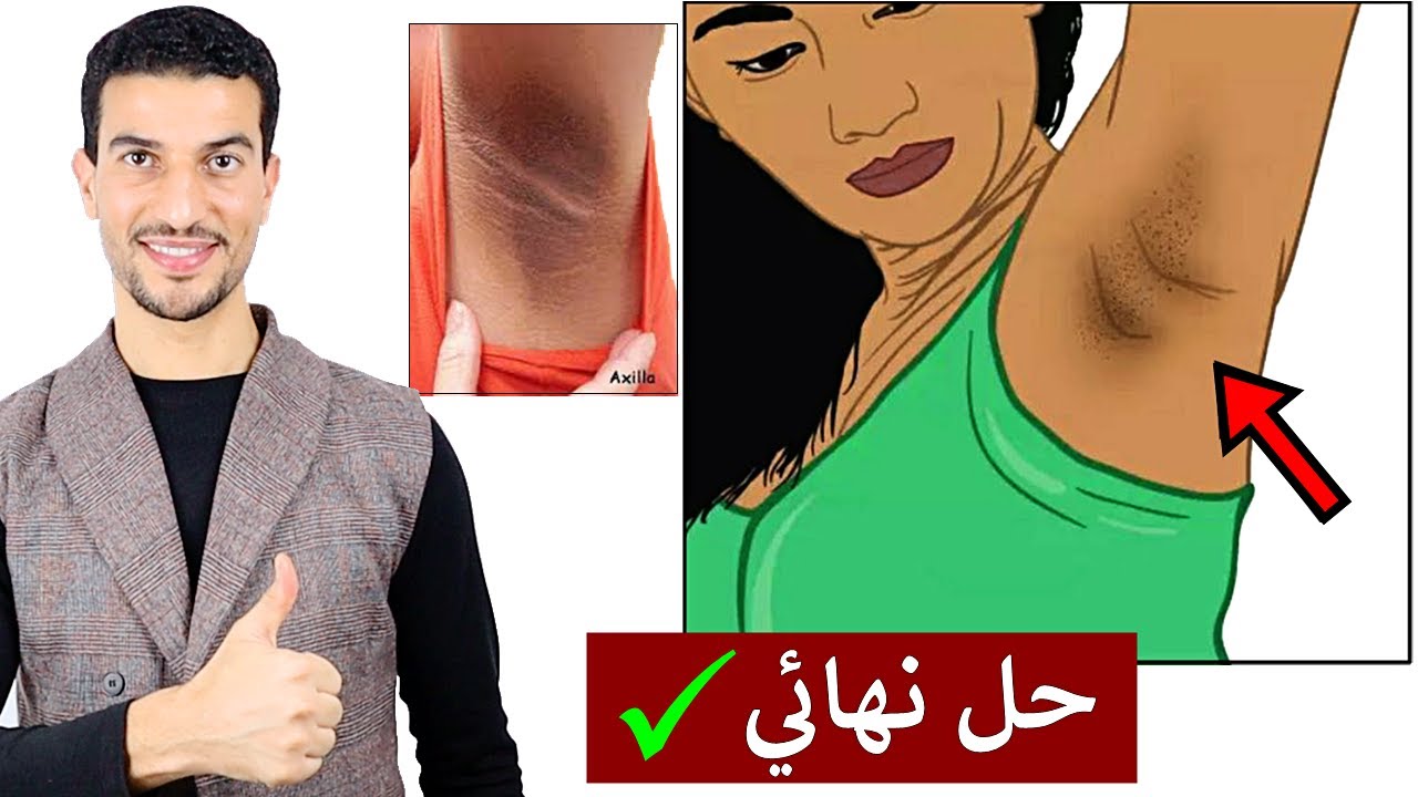 الطريقة الاسرع لتفتيح تحت الابط والاماكن الحساسة في ايام ✔️