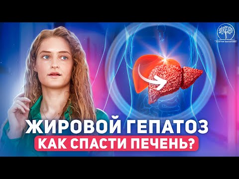 Жировой гепатоз печени. Что делать, чтобы спасти свою печень?