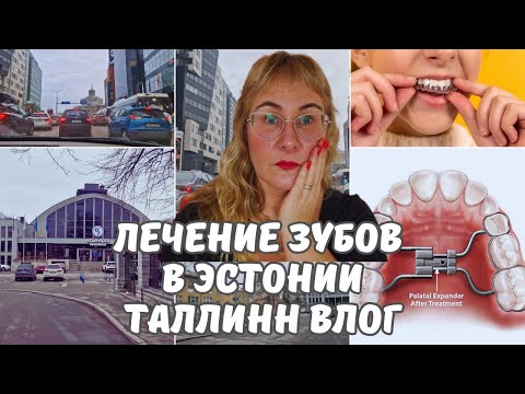 Медицина в Эстонии.Лечение зубов.Ортодонтия.Сколько стоят брекеты.Немного видео о Таллинне