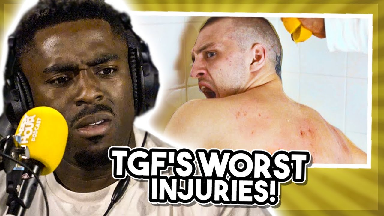 TGF Reveal Their WORST Injuries!