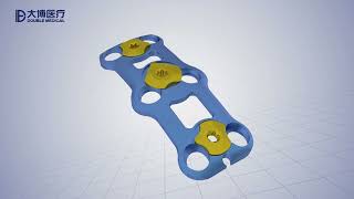 Anterior Cervical Spine Plate Ⅳ System