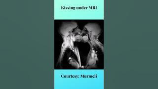 French kissing captured under MRI