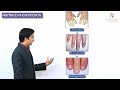 Raynaud's phenomenon - Raynaud's disease & Raynaud's syndrome