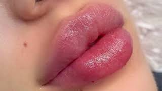 lip fillerzz++ d1ck sucking lips %