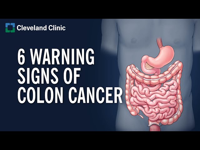 6 Warning Signs of Colon Cancer class=