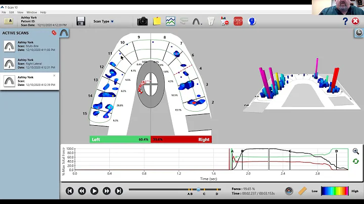 T-Scan Virtual Demonstration Featuring Dr. Ben A. ...