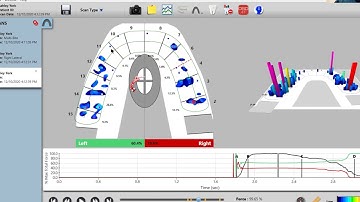 T-Scan Virtual Demonstration Featuring Dr. Ben A. Sutter