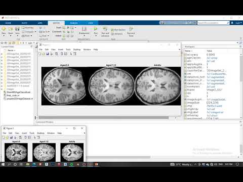 Brain MRI Age Classification using Deep Learning