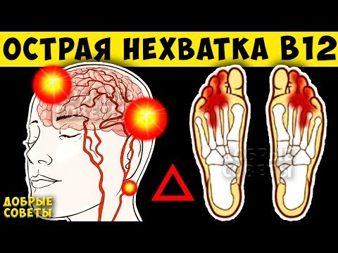 О чём не говорят! Симптомы Дефицита B12. Продукты Спасающие от дефицита Витамина Б12