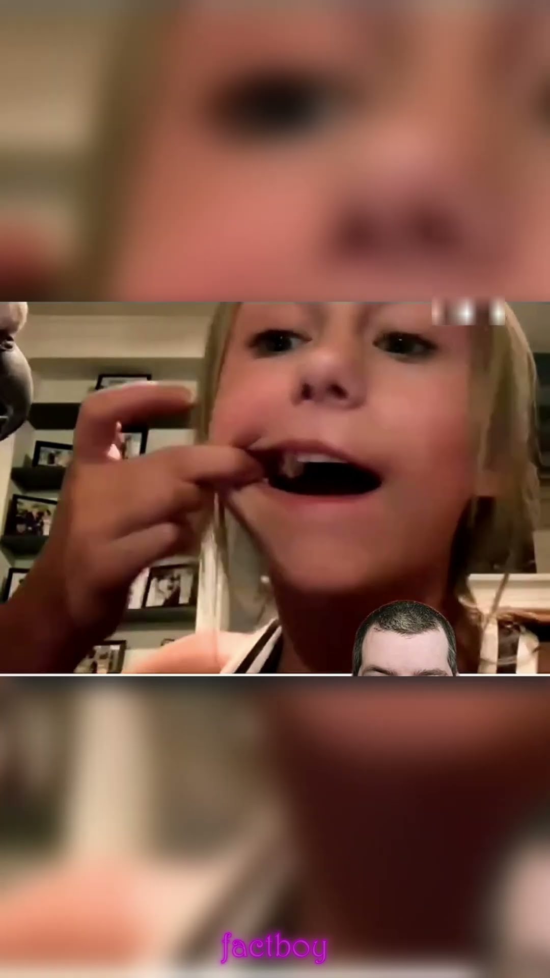 Treatment of parrot? #shortvideo