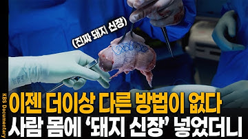 [풀버전] KBS 대기획 트랜스휴먼 3부 | 유전자 혁명 | KBS 20251126