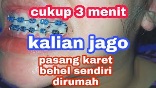 CARA PASANG KARET BEHEL GIGI DI RUMAH DENGAN BIAYA MURAH