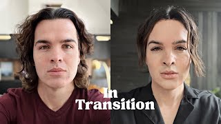 My Trans Partner’s Facial Feminization Surgery Reveal