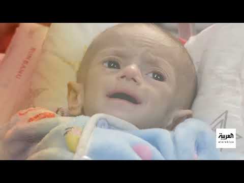 شهادة أمريكي: إطلاق نار على فلسطينيين قبل يده في غزة