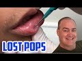 Dr. Gilmore's Lost Pops, Cysts & Pimples