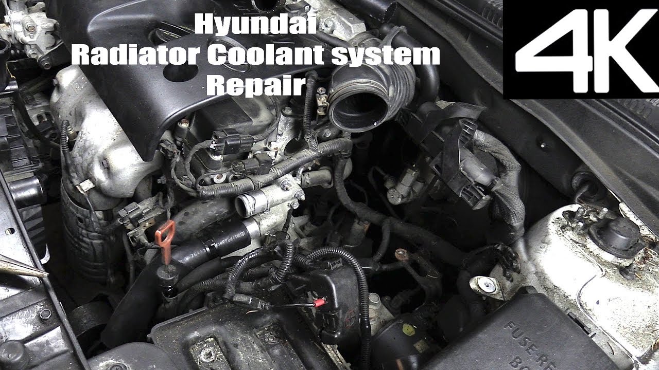 Upper Radiator Hose D934SJ for Hyundai Accent 2006 2007 2008 2009 2010 2011