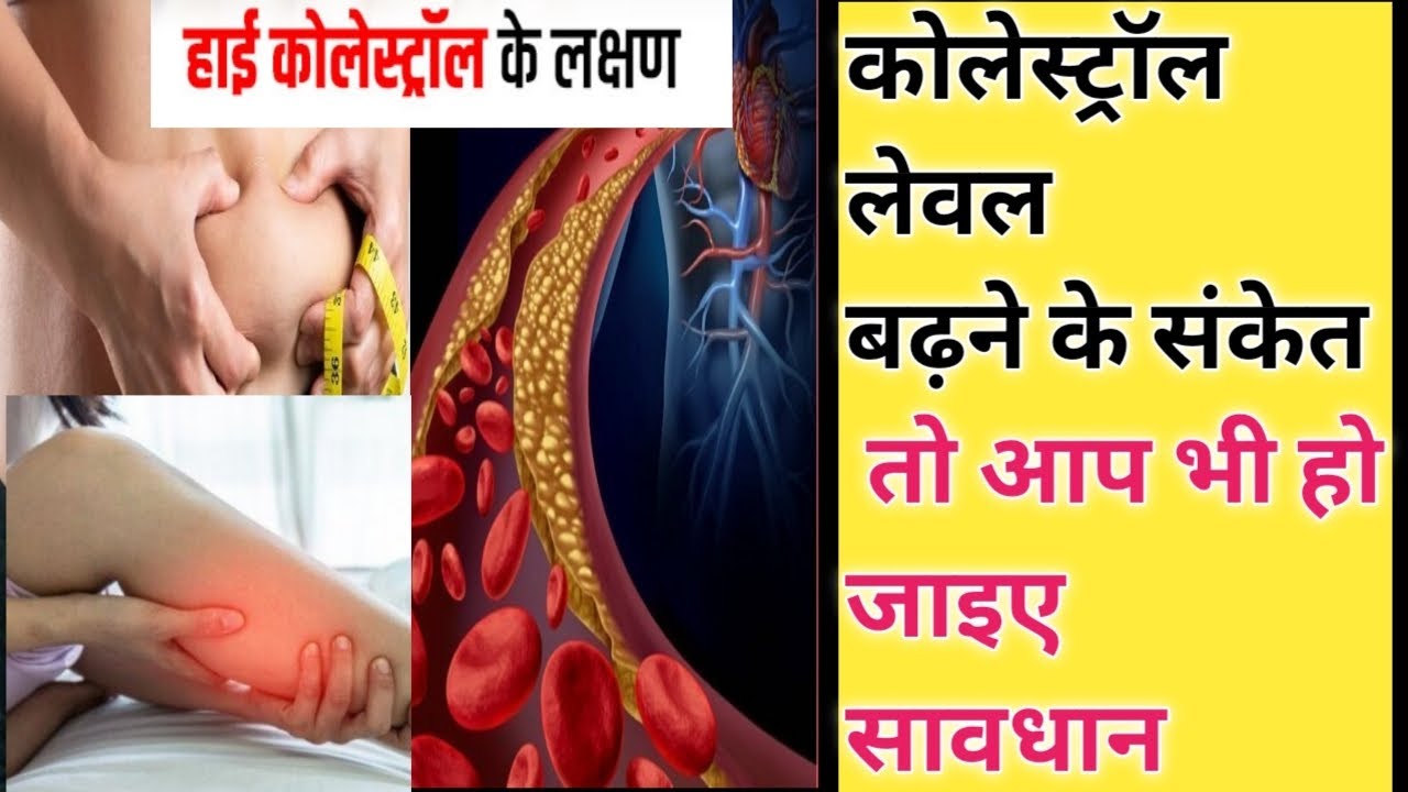 कोलेस्ट्रॉल बढ़ने के लक्षण Cholesterol level badhne ke lakshan