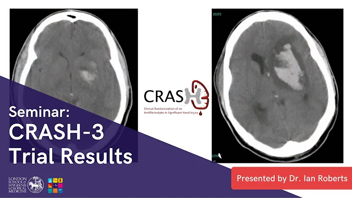 PRESENTATION 📚|| CRASH-3 Trial Results Presented by Professor Ian Roberts