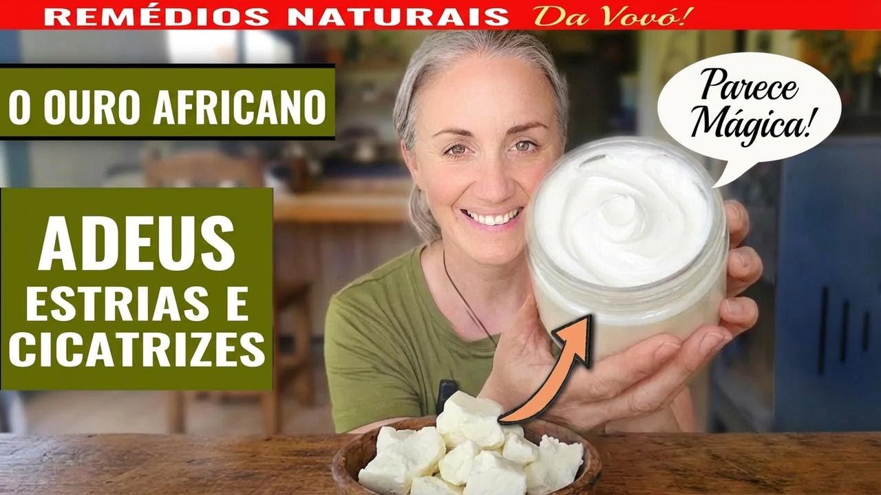 Como eliminar estrias e marcas na pele: o primeiro presente do bebê na África