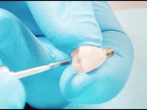 Vídeo: Els Científics Han Provat Amb èxit L'ull Biònic Implantat En Humans