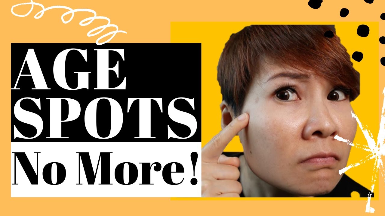 How To GET RID Of AGE SPOTS 3 NATURAL Remedies YouTube How To GET RID Of AGE SPOTS 3 NATURAL Remedies YouTube