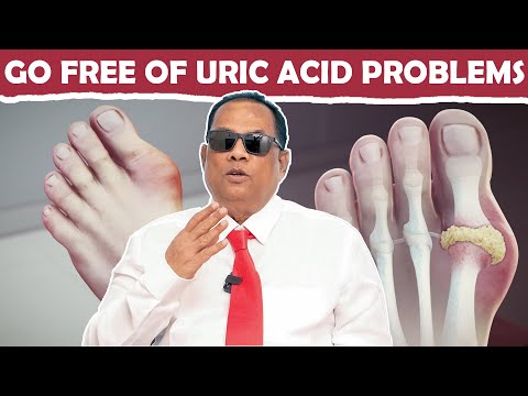 GO FREE OF URIC ACID PROBLEMS / CKN