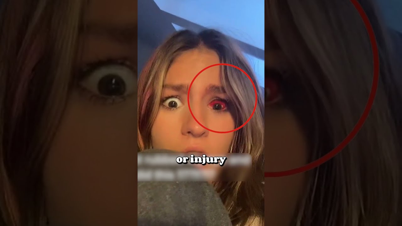 Check This Before Blinking 