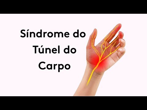 Síndrome do Túnel do Carpo !