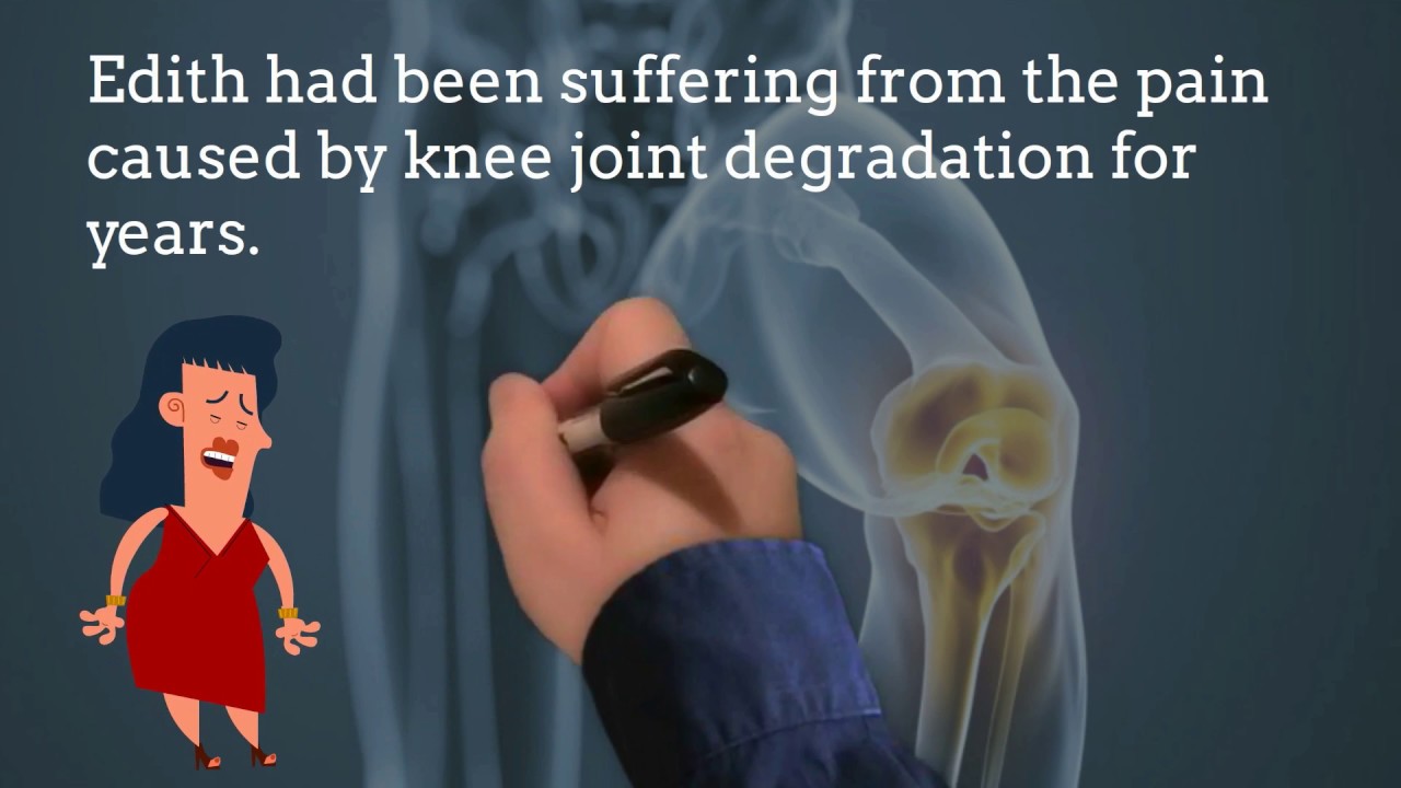 Safe Laser cancell knee replacement surgery YouTube