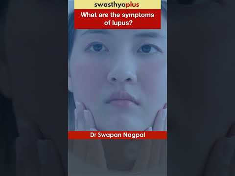 Symptoms of Lupus | SLE | Autoimmune Disease | Dr Swapan Nagpal | #Shorts