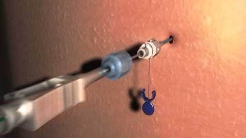 Kidney pelvis --DIRECT ACCESS+GW METHOD.mpe