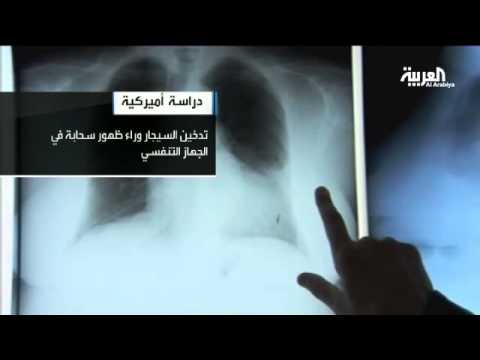 دراسة السيجار أكثر ضررا من السجائر