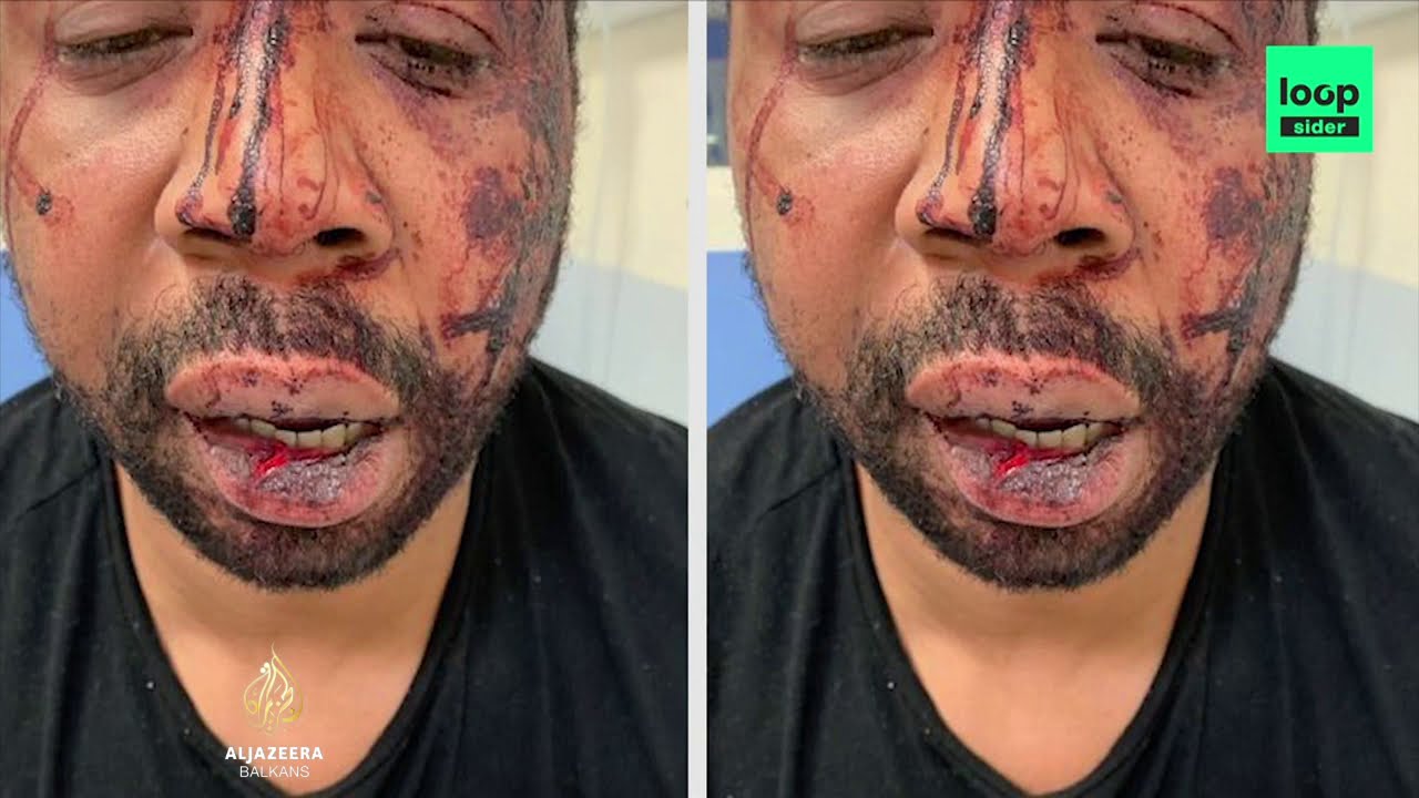 قضية جديدة تتعلق بوحشية الشرطة تثير غضباً واسعاً
