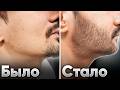 БОРОДА ЗА 3 МЕСЯЦА! Результаты от применения Mr. Volos