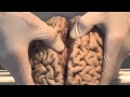 Introduction neuroanatomy lab  brain dissections