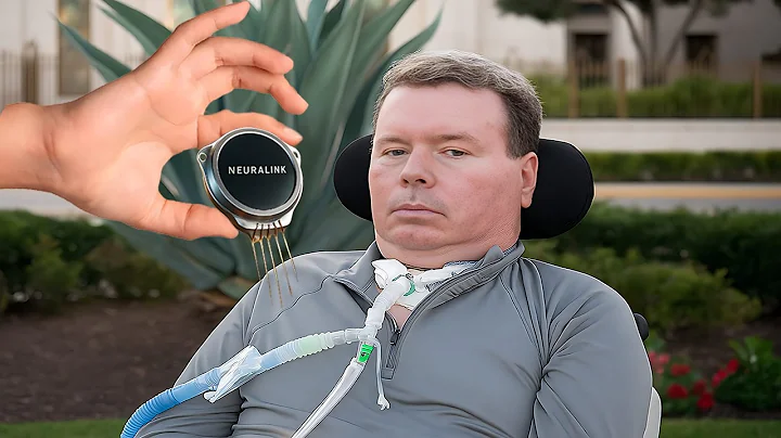 Neuralink's Brain Implant Helps Paralyzed Patient recover and Elon Musk Pays Visit to See First Hand