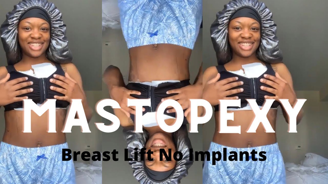 Breast Lift Without Implants/ Mastopexy Vlog YouTube