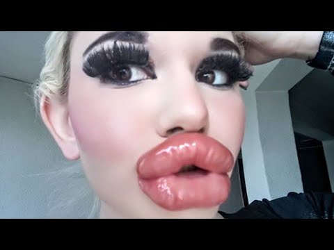 Video: Wie Sieht Der Besitzer Der Größten Lippen Der Welt Aus?