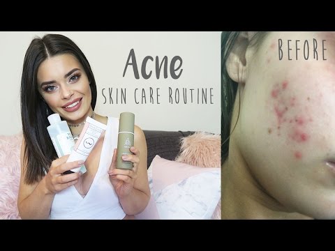 Skin Care Routine to Clear Acne | Rylie Lane