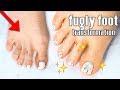 FUGLY to FAB | Pedicure Transformation