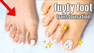 FUGLY to FAB | Pedicure Transformation