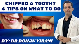 Chipped a Tooth? 4 Tips on What To Do