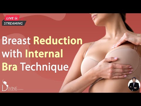 Breast Reduction 