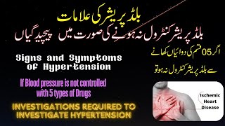 Signs and Symptoms of Hypertension. Its complications  if not treated properly. Investigations