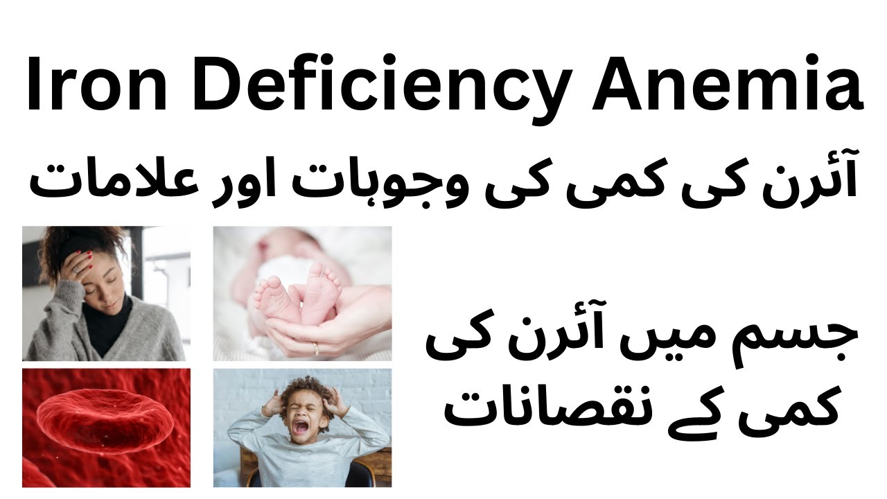Iron Deficiency Anemiairon ki kami se kya hota hai YouTube