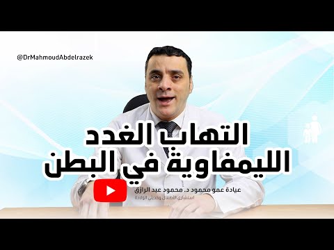 التهاب الغدد الليمفاوية في البطن دكتور محمود عبد الرازق
