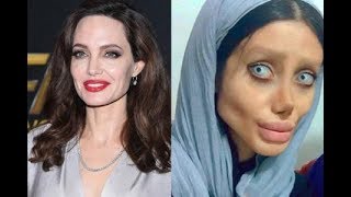 Famous Iranian Woman Has 50 Surgeries to Look Like Her Idol Angelina Jolie Net Worth